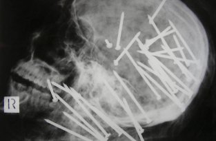 Cамые странные рентгеновские снимки (20 фото)