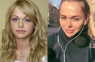 Российские звезды до пластических операций и после (10 фото)