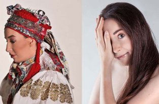 Впечатляющие селфи девушки из Словакии, родившейся с половиной лица (18 фото)