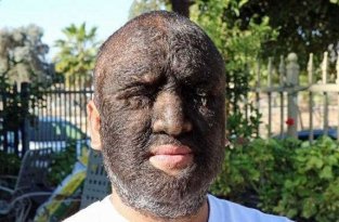 Это самый волосатый мужчина в мире: 98% его тела покрыты густыми темными волосами (5 фото + 1 видео)