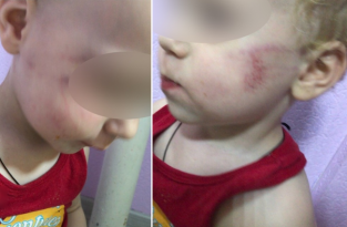 Воспитатель избила и заперла малыша в туалете из-за плача (3 фото)