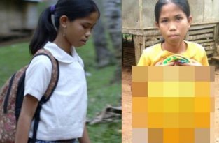 Филиппинской школьнице удалят лишние руки, растущие из живота (7 фото)