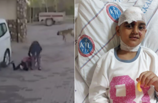 Отважная мать спасла ребенка, разжав челюсти питбулю (2 фото)
