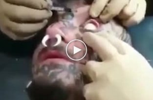 Как проходит татуирование глаза