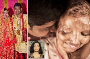 Женщина, которую 13 лет назад облили кислотой за отказ выйти замуж, нашла свою любовь (10 фото)