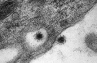 Центр «Вектор» впервые опубликовали снимок смертельного вируса (2 фото)